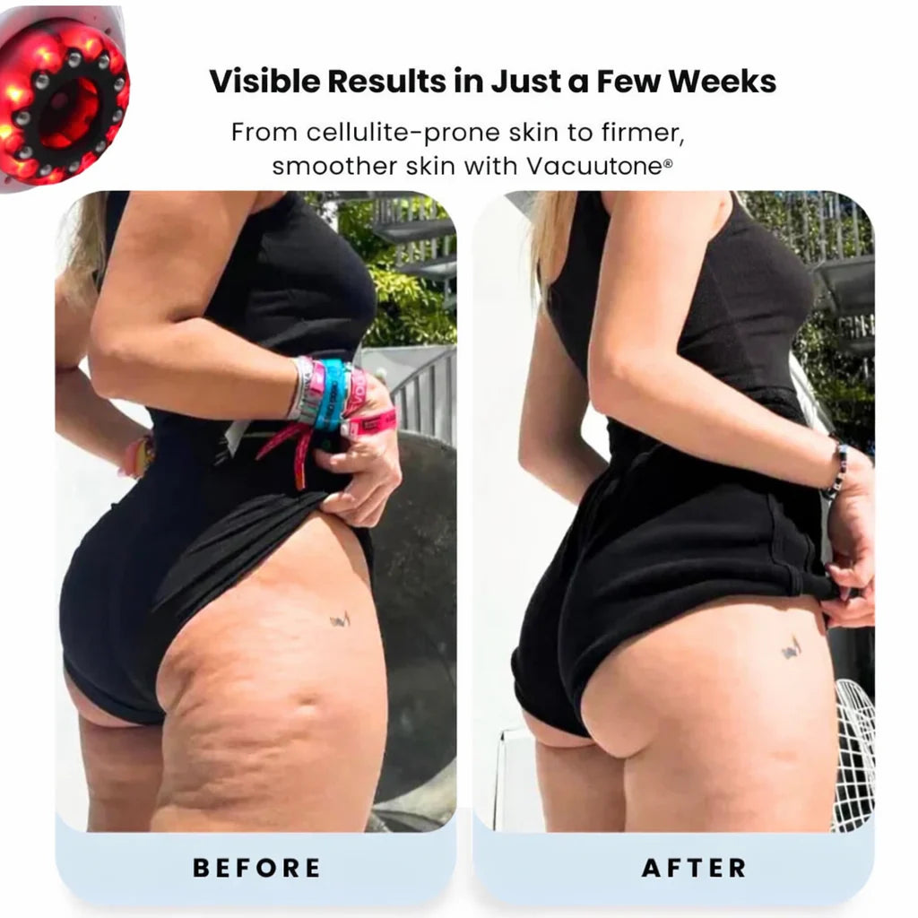 Beguz Recovery System